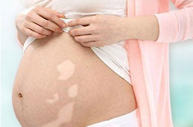武汉孕妇得白斑常见因素有哪些呢