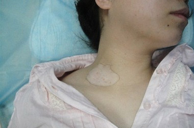 武汉白斑医院：女性处于生理期间白斑能治疗吗